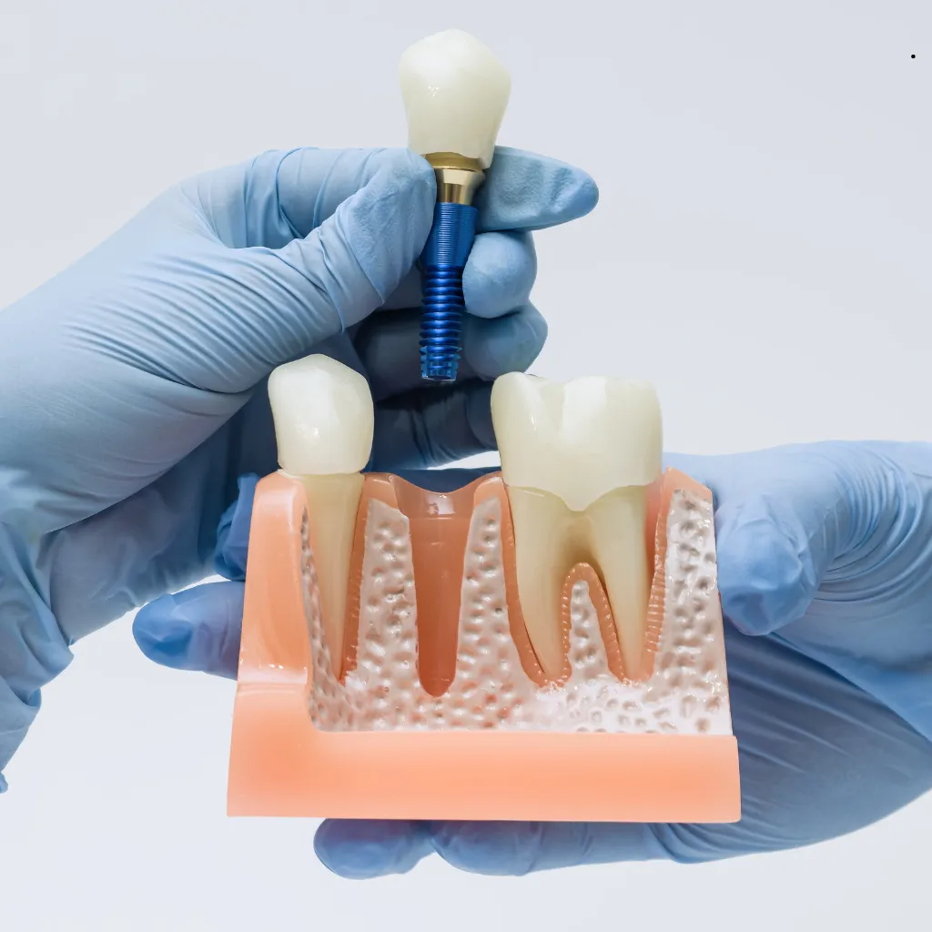 QualCert Level 3 Diploma in Dental Implantology