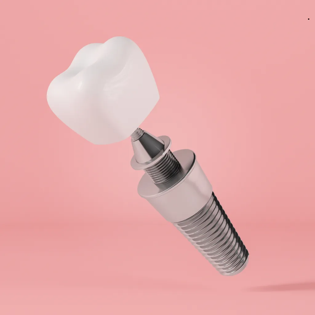 QualCert Level 3 Diploma in Implant Dentistry 5 QualCert Level 3 Diploma in Implant Dentistry