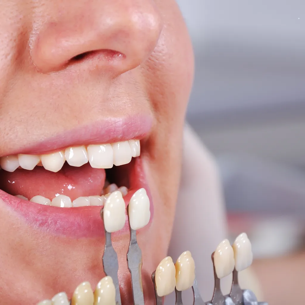 QualCert Level 6 Diploma in Aesthetic Dentistry