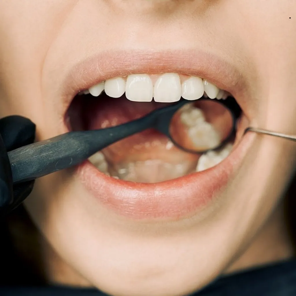 QualCert Level 7 Postgraduate Diploma in Oral Medicine