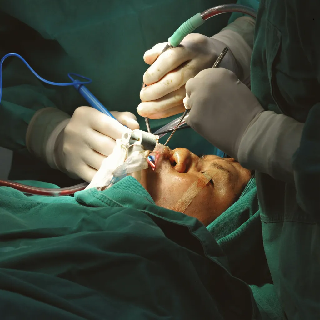 QualCert Level 7 Postgraduate Diploma in Oral and Maxillofacial Surgery (PgDOMS) 5 QualCert Level 7 Postgraduate Diploma in Oral and Maxillofacial Surgery