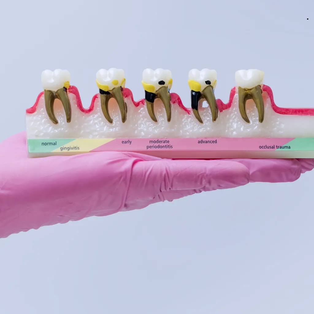 QualCert Level 7 Postgraduate Diploma in Periodontology (PgD Periodontology)