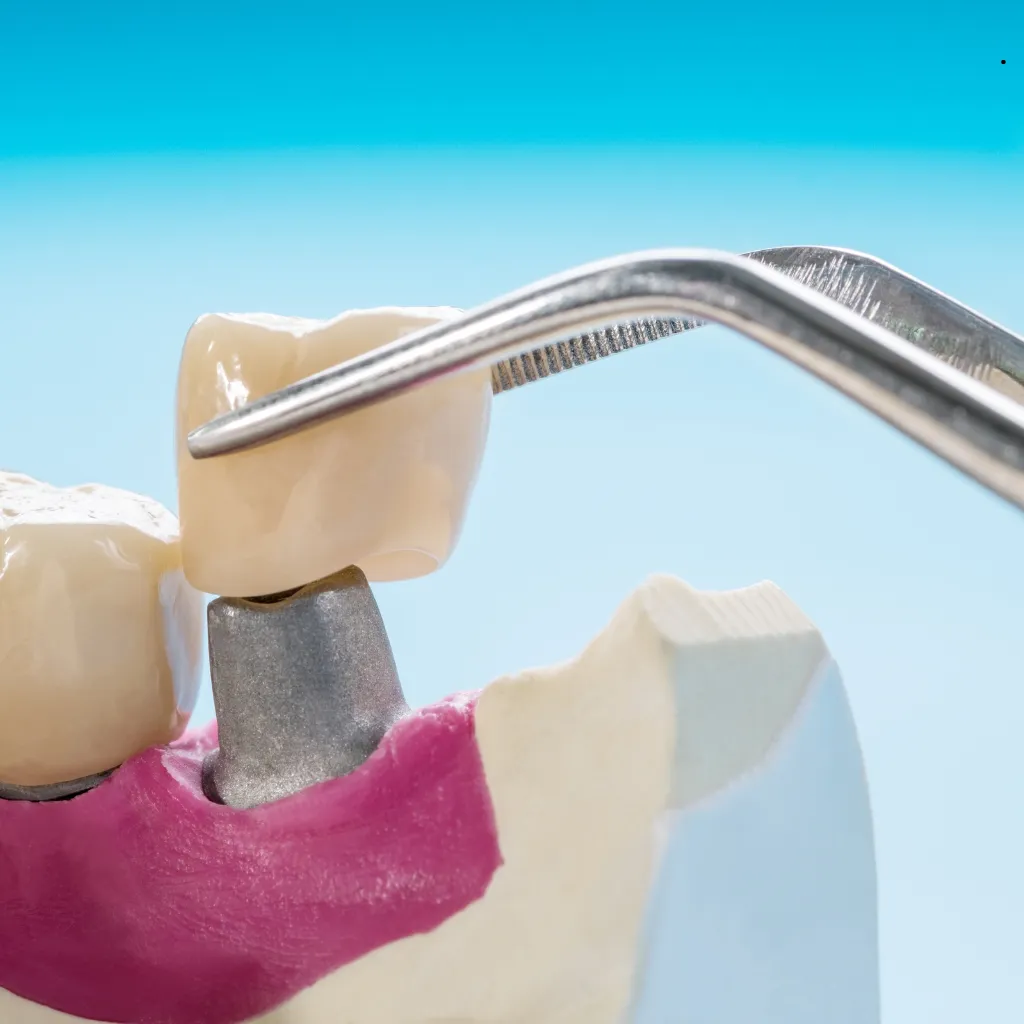 QualCert Level 7 Postgraduate Diploma in Prosthodontics 